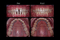 238-Diastemi (spazi tra i denti)